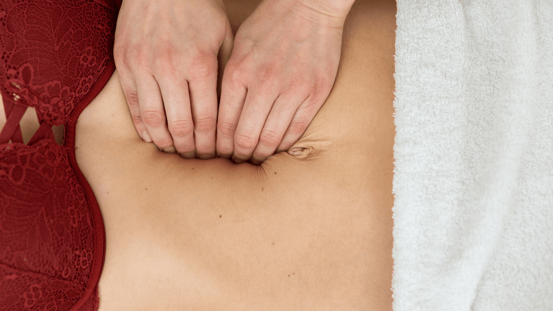 Severe diastasis recti can be treated with surgery